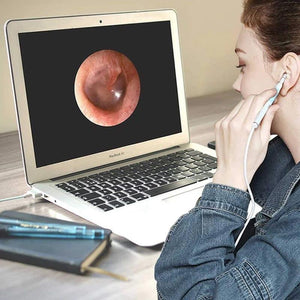 Caméra d'Endoscope Mise au Point Automatique